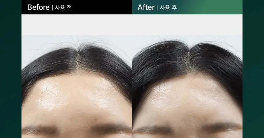 [2025어워즈/2년연속수상] 바이브랩 리바이브 테라피 헤어 스칼프 앤 브로우 앰플 더블기획 상세페이지 17